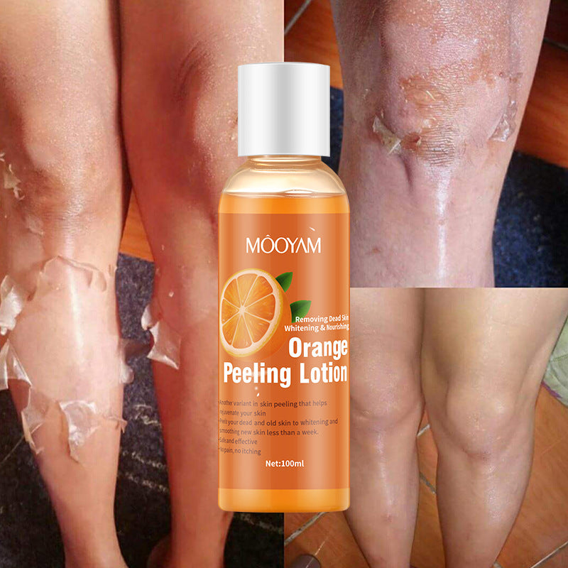 Orange Skin Peeling Lotion
